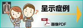 呈示症例